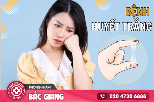 Tổng quan về bệnh huyết trắng mà chị em cần lưu ý