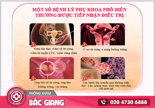 Bệnh phụ khoa âm thầm gây hại - Đừng chủ quan với dấu hiệu