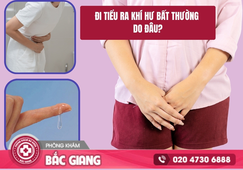 Đi tiểu ra khí hư bất thường là do vấn đề gì?