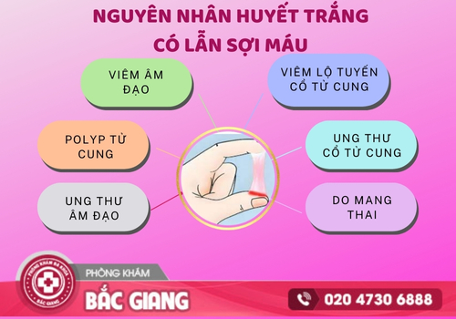 Huyết trắng có lẫn sợi máu và những tác hại nguy hiểm