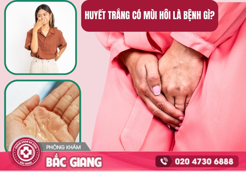 Huyết trắng có mùi hôi xuất phát từ những nguyên nhân nào?