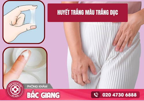 Huyết trắng màu trắng đục và những nguyên nhân thường gặp