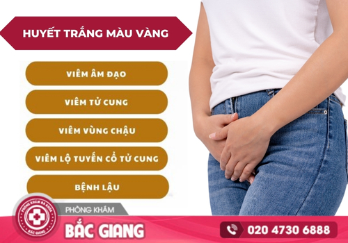 Huyết trắng màu vàng Biểu hiện bệnh lý phụ khoa đáng lo ngại