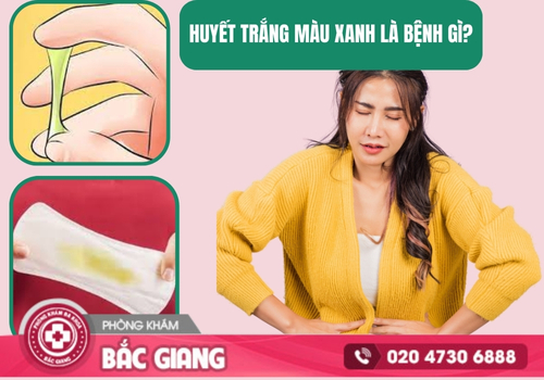 Huyết trắng màu xanh cảnh báo điều gì? Nhận biết và khắc phục sớm