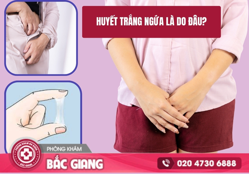 Nguyên nhân và cách điều trị hiện tượng huyết trắng ngứa