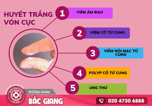 Huyết trắng vón cục và những mối nguy hiểm tiềm ẩn