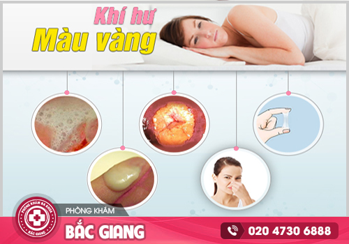 Ngứa vùng kín và ra dịch màu vàng có sao không?