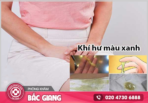 Ngứa vùng kín ra khí hư màu xanh và cách điều trị hiệu quả