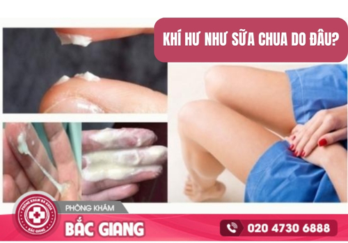 Ra dịch khí hư như sữa chua nguyên nhân và cách điều trị