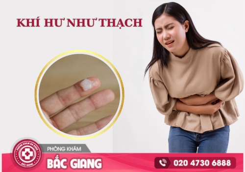 Khí hư như thạch là dấu hiệu gì? Cảnh báo bệnh phụ khoa