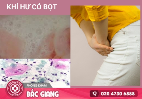 Khí hư có bọt và những nguyên nhân thường gặp