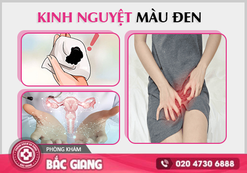 Kinh nguyệt màu đen - Cảnh báo bệnh phụ khoa âm thầm
