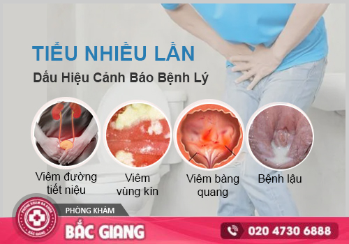 Khổ vì đi tiểu liên tục? Xem ngay 6 bệnh lý phổ biến gây tiểu nhiều