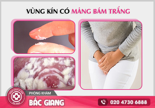 Vùng kín có mảng trắng, đốm trắng - Khi nào cần đi khám ngay?